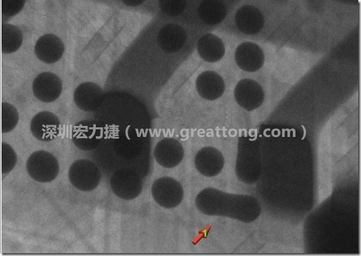 BGA因為焊墊變小，造成錫膏過多而最終形成焊接短路的結(jié)果。